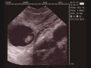 SLV 2000 Sektör Problu Veteriner Ultrason Cihazı