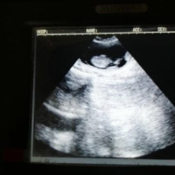 SLV 2000 Sektör Problu Veteriner Ultrason Cihazı