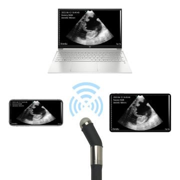 SLV 1000 Kablosuz Veteriner Ultrason Cihazı